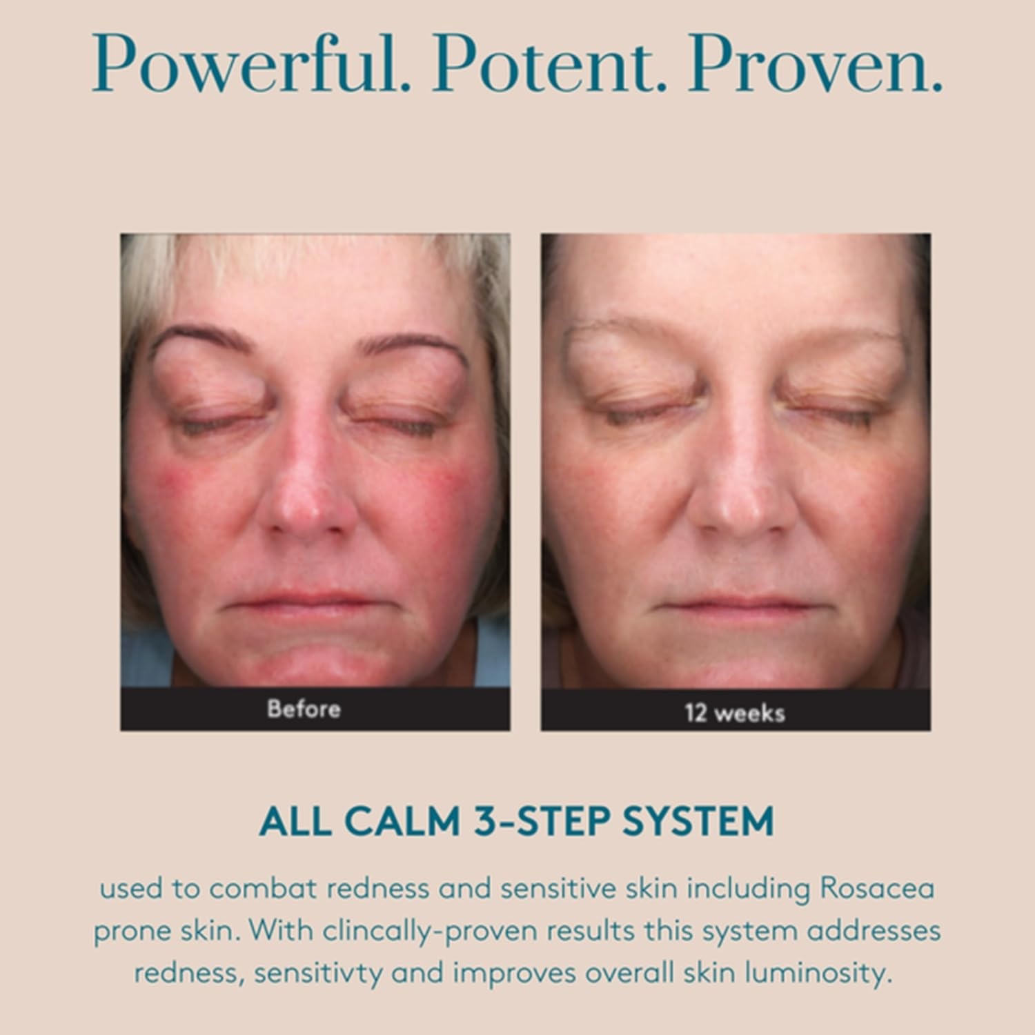 image:imageColorescience All Calm MultiCorrection Serum 1 fl oz