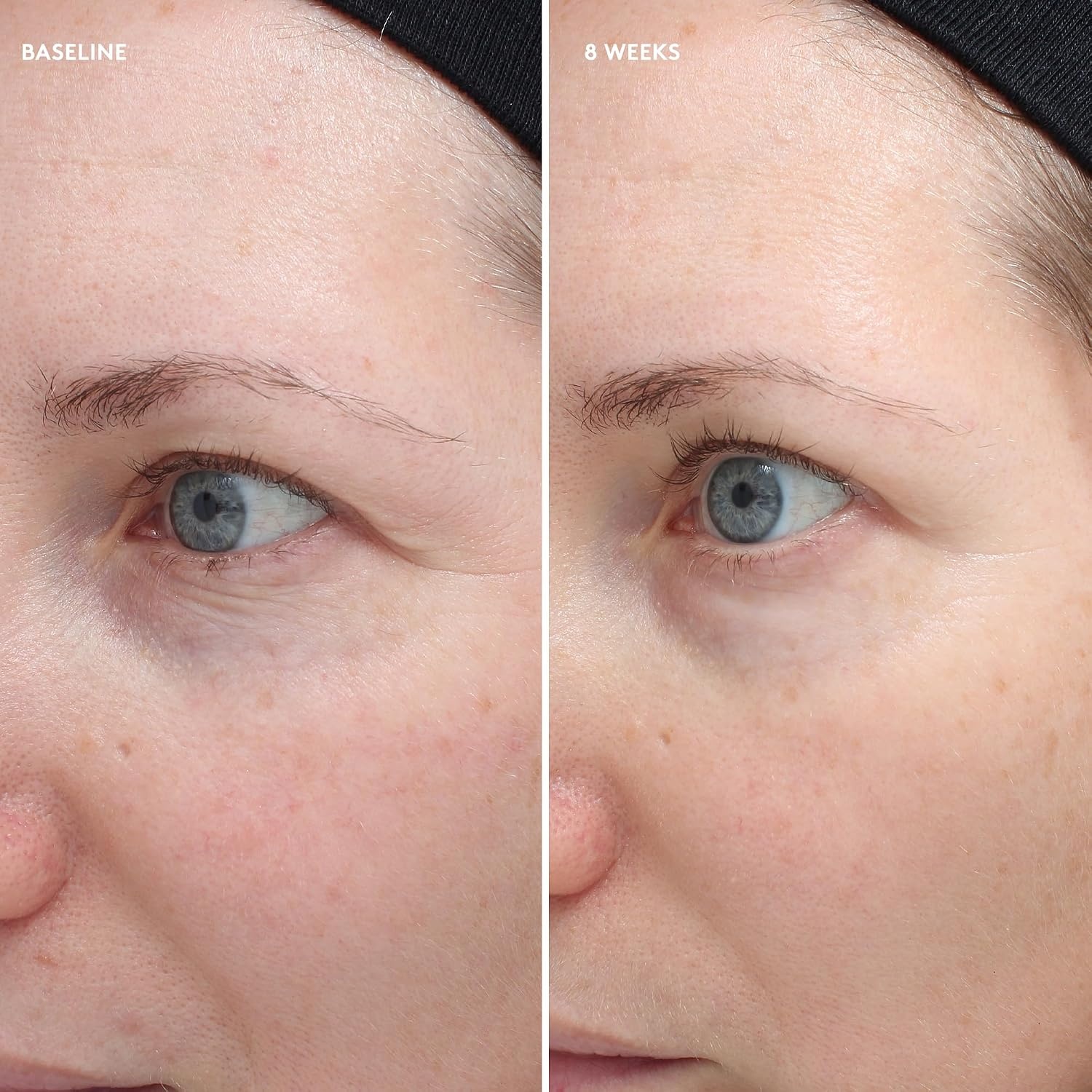 image:imageColorescience Total Eye Firm amp Repair Cream 6 fl oz